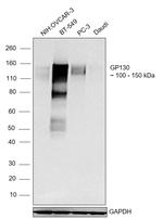 CD130 (GP130) Recombinant Rabbit Monoclonal Antibody (BLR114H)