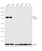 BCL6 Recombinant Rabbit Monoclonal Antibody (BLR143H)
