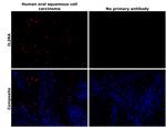 CD25 Antibody in Immunohistochemistry (Paraffin) (IHC (P))