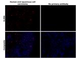 CD25 Antibody in Immunohistochemistry (Paraffin) (IHC (P))