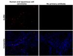 CD25 Antibody in Immunohistochemistry (Paraffin) (IHC (P))