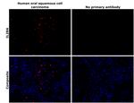 CD25 Antibody in Immunohistochemistry (Paraffin) (IHC (P))