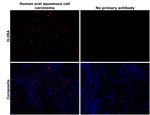 CD25 Antibody in Immunohistochemistry (Paraffin) (IHC (P))