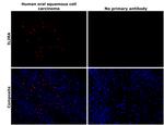 CD25 Antibody in Immunohistochemistry (Paraffin) (IHC (P))
