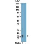 H2BK11ac Recombinant Rabbit Monoclonal Antibody (RM456)