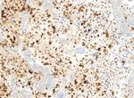 H3.3 G34R oncohistone mutant Antibody in Immunohistochemistry (IHC)