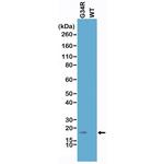 H3.3 G34R oncohistone mutant Recombinant Rabbit Monoclonal Antibody (RM240), Biotin