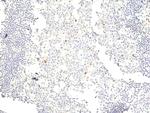 Phospho-Aurora A/B/C (Thr288, Thr232, Thr198) Recombinant Rabbit Monoclonal Antibody (RM454)