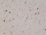 Calretinin Recombinant Rabbit Monoclonal Antibody (RM324)