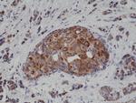 Cytokeratin 18 Recombinant Rabbit Monoclonal Antibody (RM279)