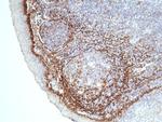 Podoplanin Antibody in Immunohistochemistry (Paraffin) (IHC (P))