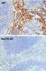 MERTK Recombinant Rabbit Monoclonal Antibody (RM469)