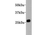 Kappa Light Chain Monoclonal Antibody (A11-G11)