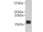 Transthyretin Monoclonal Antibody (3-E11)
