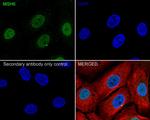 MSH6 Recombinant Rabbit Monoclonal Antibody (PD00-26)