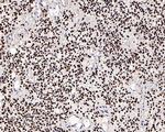 SOX2 Antibody in Immunohistochemistry (Paraffin) (IHC (P))
