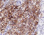 c-Kit Antibody in Immunohistochemistry (Paraffin) (IHC (P))