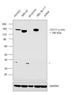 c-Kit Antibody in Western Blot (WB)