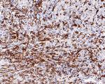 CD16 Antibody in Immunohistochemistry (Paraffin) (IHC (P))