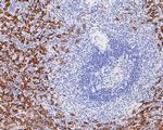 CD16 Antibody in Immunohistochemistry (Paraffin) (IHC (P))