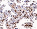 Factor XIII A Antibody in Immunohistochemistry (Paraffin) (IHC (P))