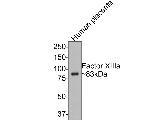 Factor XIII A Antibody in Western Blot (WB)