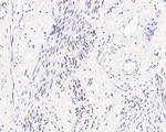 Estrogen Receptor alpha Antibody in Immunohistochemistry (Paraffin) (IHC (P))