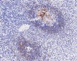 CD23 Antibody in Immunohistochemistry (Paraffin) (IHC (P))