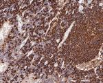 CD20 Recombinant Rabbit Monoclonal Antibody (PD00-02)