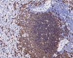 CD20 Antibody in Immunohistochemistry (Paraffin) (IHC (P))