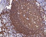 CD20 Antibody in Immunohistochemistry (Paraffin) (IHC (P))