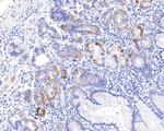 CECR5 Recombinant Rabbit Monoclonal Antibody (JE64-76)