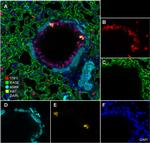 Ki-67 Antibody in Immunocytochemistry (ICC/IF)