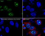 Ki-67 Recombinant Rabbit Monoclonal Antibody (SR00-02)