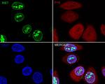 Ki-67 Antibody in Immunohistochemistry (Frozen) (IHC (F))