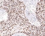 Ki-67 Antibody in Immunohistochemistry (Paraffin) (IHC (P))