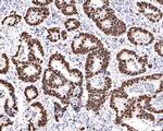 Ki-67 Antibody in Immunohistochemistry (Paraffin) (IHC (P))