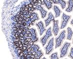 Ki-67 Antibody in Immunohistochemistry (Paraffin) (IHC (P))