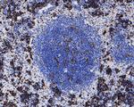 Ki-67 Antibody in Immunohistochemistry (Paraffin) (IHC (P))