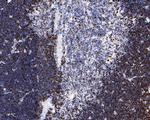 Ki-67 Antibody in Immunohistochemistry (Paraffin) (IHC (P))
