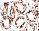 RBMXL2 Antibody in Immunohistochemistry (Paraffin) (IHC (P))