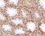 RBMXL2 Antibody in Immunohistochemistry (Paraffin) (IHC (P))