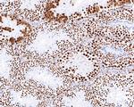 hnRNP M Antibody in Immunohistochemistry (Paraffin) (IHC (P))