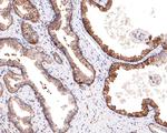 IQGAP2 Antibody in Immunohistochemistry (Paraffin) (IHC (P))