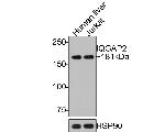 IQGAP2 Antibody in Western Blot (WB)