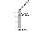 IQGAP2 Antibody in Western Blot (WB)