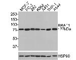 BAAT1 Recombinant Rabbit Monoclonal Antibody (JE64-71)
