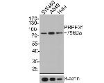 GNE Recombinant Rabbit Monoclonal Antibody (JE64-81)