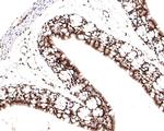 TCEA1 Antibody in Immunohistochemistry (Paraffin) (IHC (P))