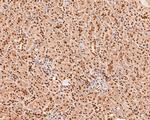 TCEA1 Antibody in Immunohistochemistry (Paraffin) (IHC (P))